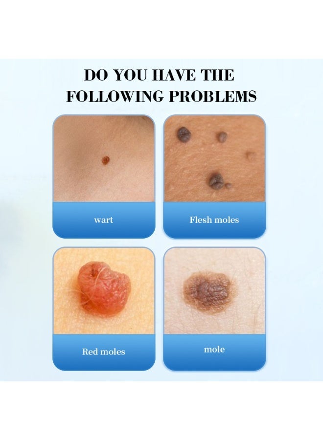 REVAREVA Mole Removal and Repairing Topical Solution, 20ml, removes warts and corns, provides precise care, and gently fades facial blemishes. - Image 3